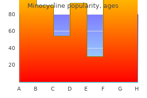 50 mg minocycline order
