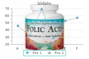 order 120 mg sildalis with amex