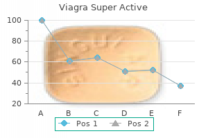 generic viagra super active 25 mg line