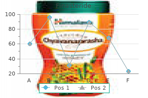 finasteride 5 mg overnight delivery