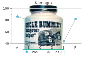 discount 100 mg kamagra mastercard