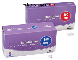 150 mg ranitidine order