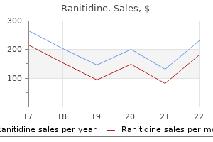 generic ranitidine 300 mg with mastercard