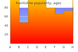 purchase ranitidine 150 mg on-line