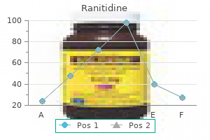 ranitidine 300 mg order with mastercard